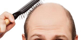 No más calvicie