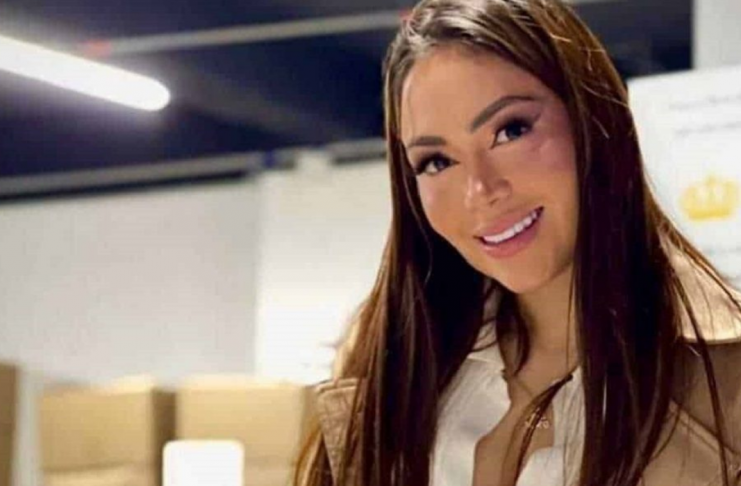 Epa Colombia hace las pases con Transmilenio Epa Colombia