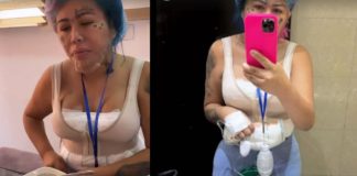 Mira el nuevo procedimiento que se hizo Yina Calderón Mira el nuevo procedimiento que se hizo Yina Calderón