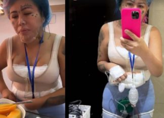 Mira el nuevo procedimiento que se hizo Yina Calderón Mira el nuevo procedimiento que se hizo Yina Calderón