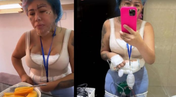 Mira el nuevo procedimiento que se hizo Yina Calderón Mira el nuevo procedimiento que se hizo Yina Calderón