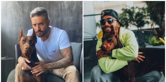 Así quedó Maluma luego de ser mordido por su perro Así quedó el rostro de Maluma luego de ser mordido por su perro