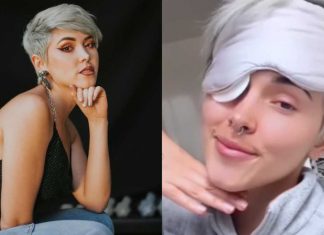 Kika Nieto confesó que tiene un tumor en un ojo kika nieto