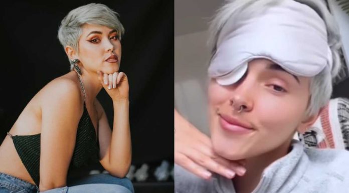 Kika Nieto confesó que tiene un tumor en un ojo kika nieto