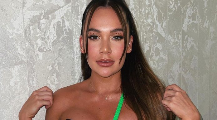 Foto: Lina Tejeiro muestra su cicatriz tras las cirugías por biopolímeros Lina Tejeiro